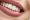 composite dental